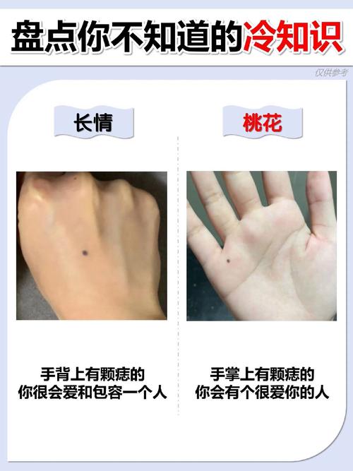 右手手背上有痣的女人命運 右手背有痣的男人代表什么