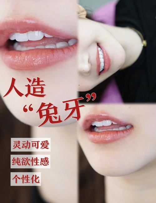 面相牙齒 有兔牙面相的女人命運如何