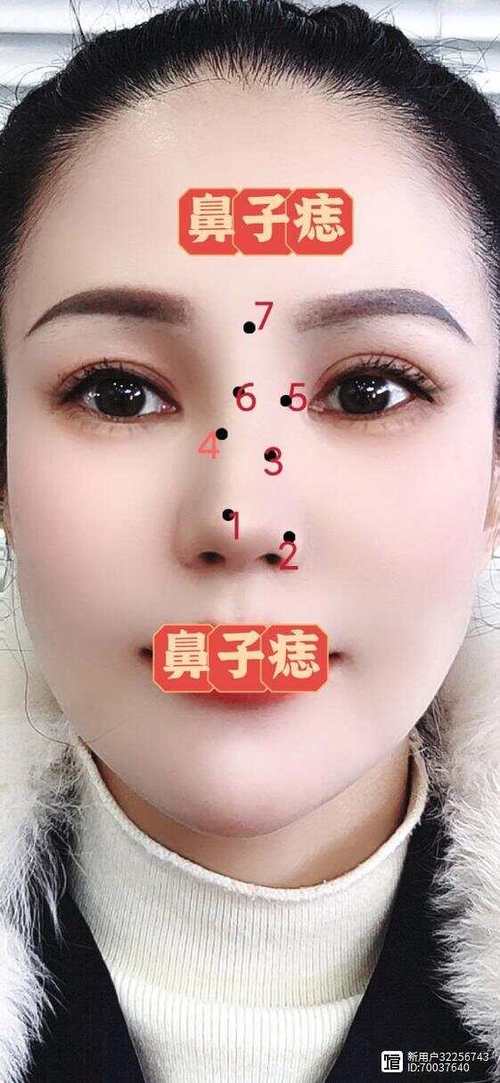 女人鼻子上長痣好嗎