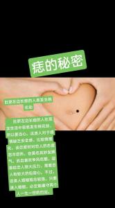 女人肚臍眼長痣預(yù)示會發(fā)生桃花劫