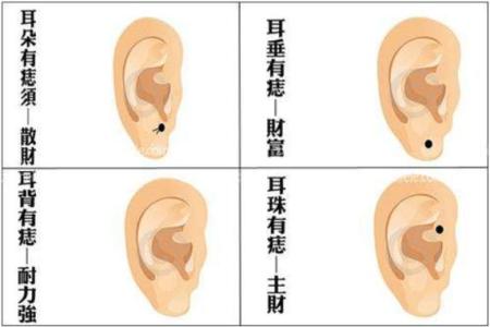 耳部長痣好不好?