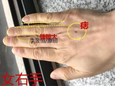 手背上有痣的男人