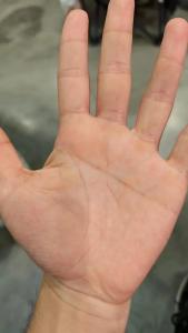 男嬰生下來就是左斷掌是不是好命