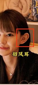 女人有招風耳招人喜歡嗎