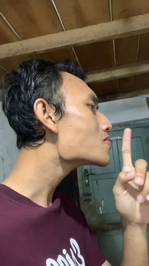 顎骨突出的人都很丑