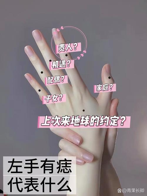 女人左手掌心有痣 左手長痣的女人代表什么