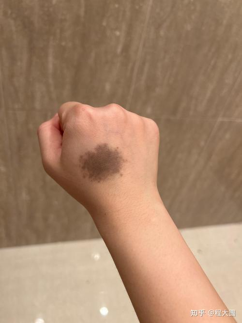 手背有胎記是什么命 手背有胎記命理解析