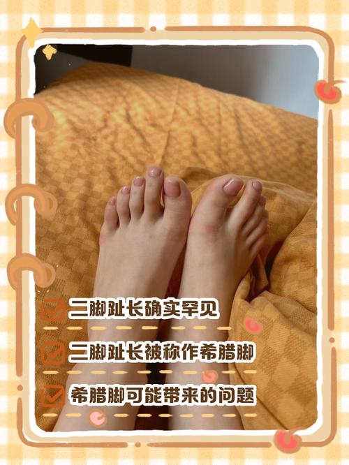 腳二拇指比大拇指長代表什么 腳趾二拇指比大拇指長好不好