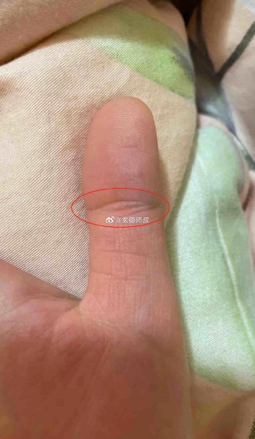 手上長有鳳眼紋的人會怎樣