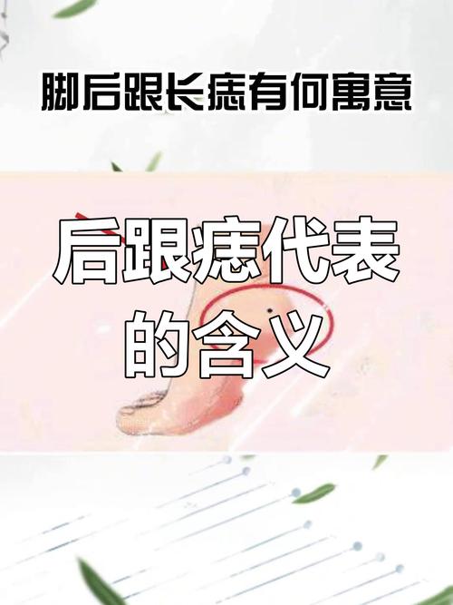 右腳腳后跟有痣代表什么 腳后跟長痣代表什么