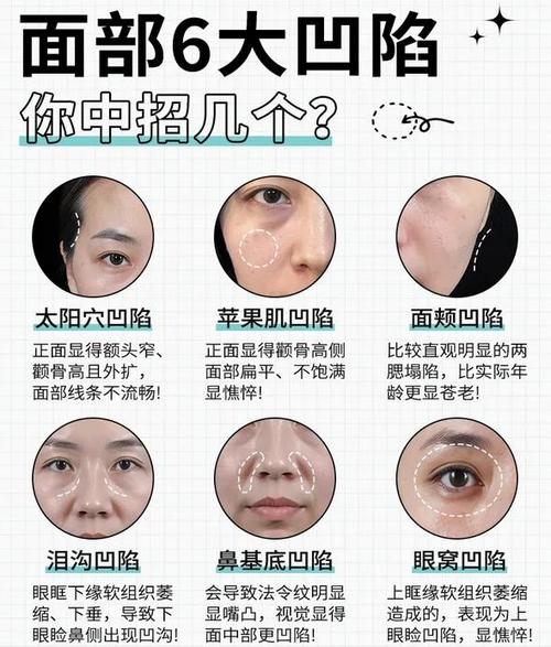 臉上瑕疵預(yù)知你近期運(yùn)勢