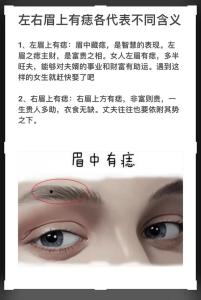 女生左眉毛上有痣代表什么 女生左眉毛下方有痣好不好