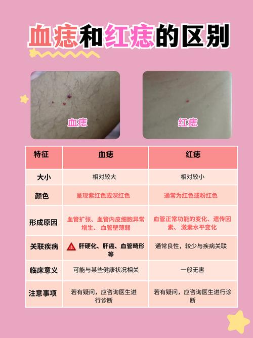 身上長紅痣代表什么意義