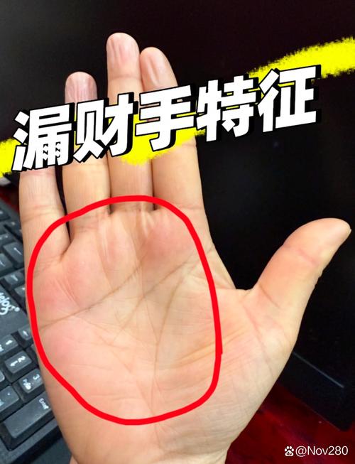 手上長有＂漏財紋＂好嗎?