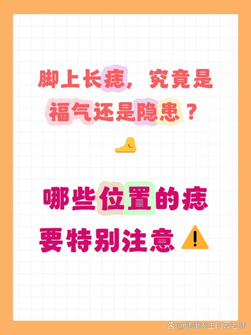 腳面長痣圖解分析