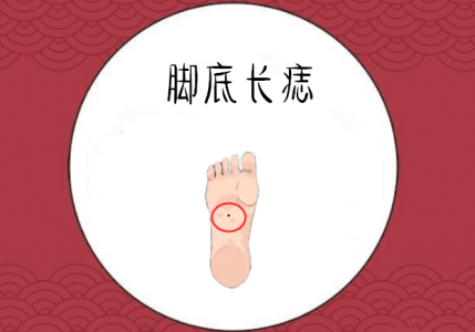 腳部長痣圖解好不好?