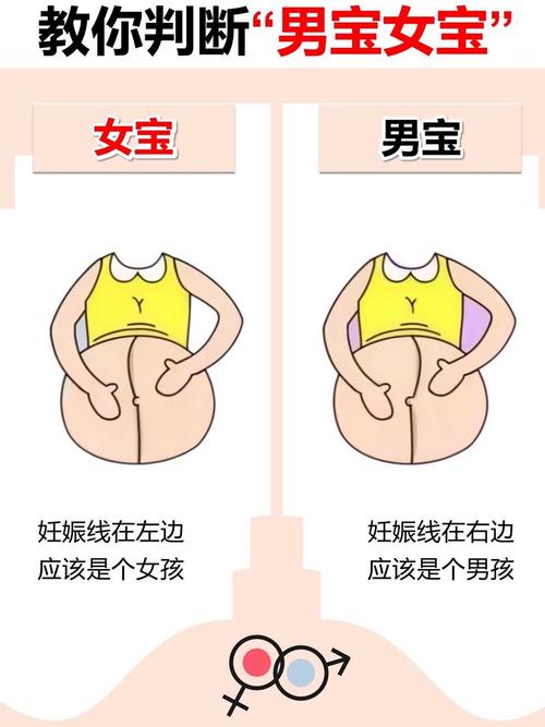 妊娠線看男女準嗎 有什么說法