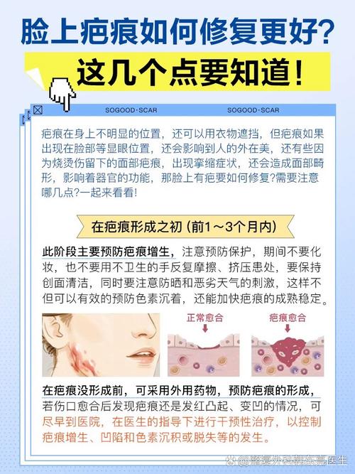 臉上有疤痕面相好不好 怎么樣