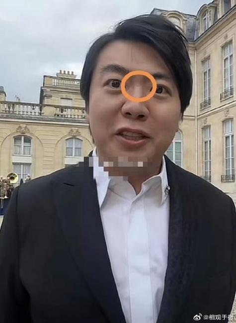 男人山根低陷一生運勢不好是真的嗎