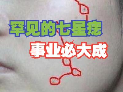 千年一遇的痣 三星痣非常少見