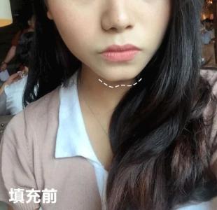 美人溝下巴的女人是不是很有福氣