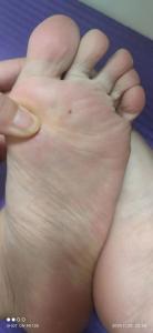 腳底有痣的男人富貴雙全是真的嗎