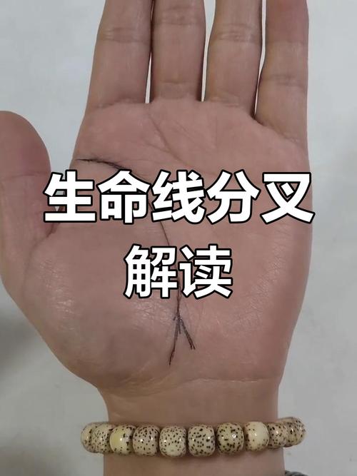 生命線分叉會生大病嗎 生命線能看出什么