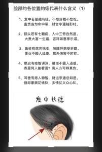 頭發(fā)里有痣代表什么   頭發(fā)鬢角位置長痣易犯小人