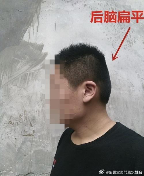 富貴嬰兒面相 枕骨高的寶寶腦袋很好使