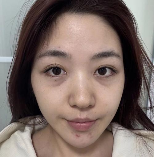 女人命好的面相 眼袋平滿亮澤