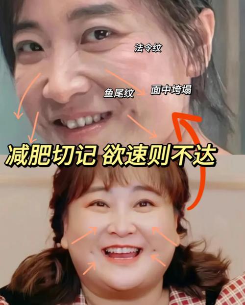 為什么臉瘦的人福氣都不好