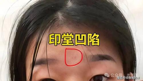 破相就是過劫嗎 有疤痕的面相怎么樣