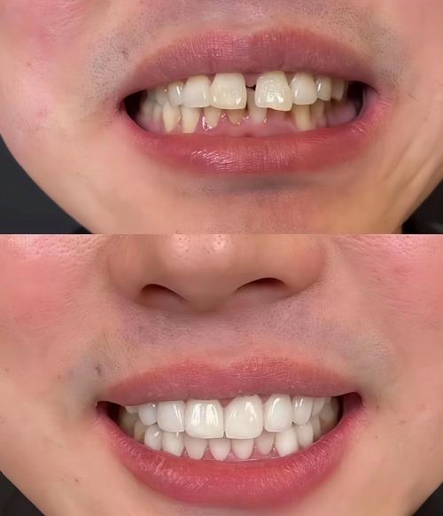 面相看什么樣的牙齒最漏財