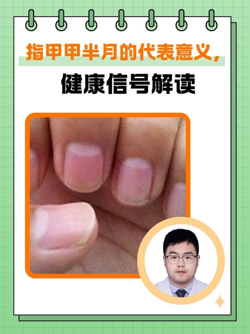 手指甲上的月牙代表什么意思 指甲半月痕解析