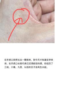 虎口長痣代表什么