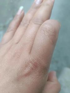 左手食指有疤代表什么 左手食指有疤的傳說(shuō)