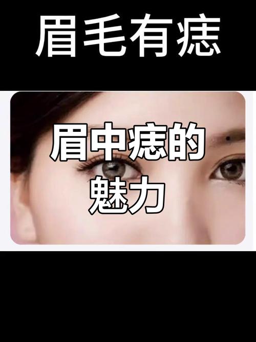 眉毛里有痣好嗎