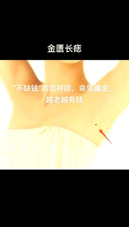 哪里長痣將來會巨富 金匱長痣象征家境比較富裕