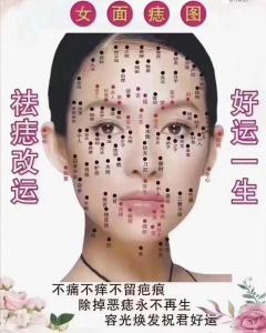 桃花痣的正確位置圖片 印堂有痣為桃花痣易有桃花劫