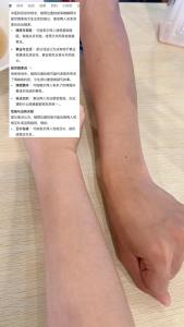 情侶二人痣長在同一個位置 情侶同一個位置的痣民間說法