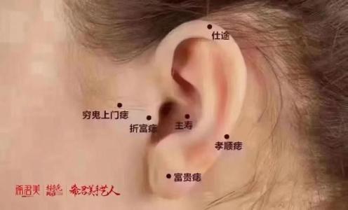 耳朵哪里長痣最好全圖 耳朵痣的人命好不好