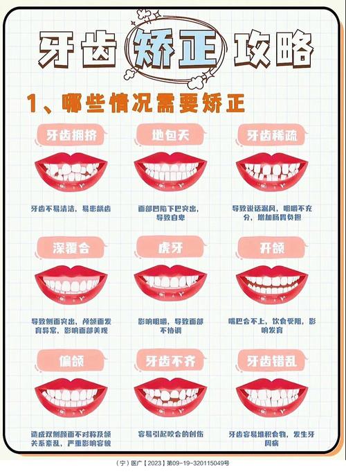 女人齙牙面相運勢怎么樣