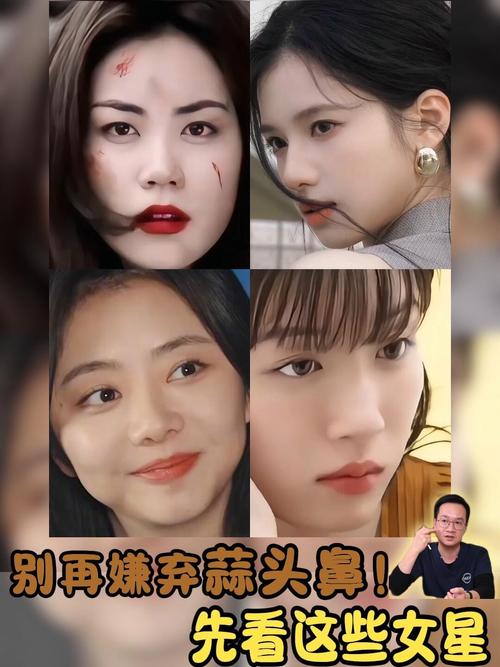 盤點(diǎn)蒜頭鼻女明星都有哪些