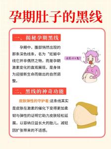 妊娠線什么時(shí)候明顯，顏色會(huì)越變?cè)缴睿? />
								</a>
								<a href=
