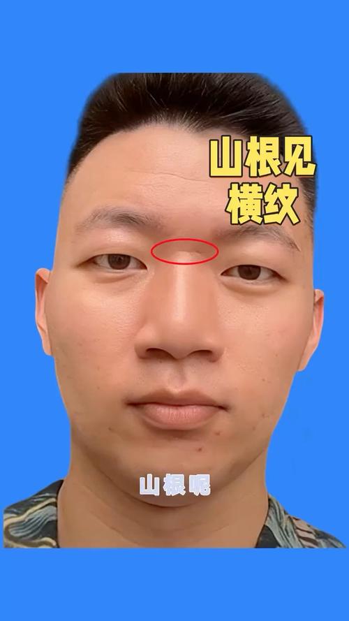 山根有橫紋的男人大富大貴 貴人運好