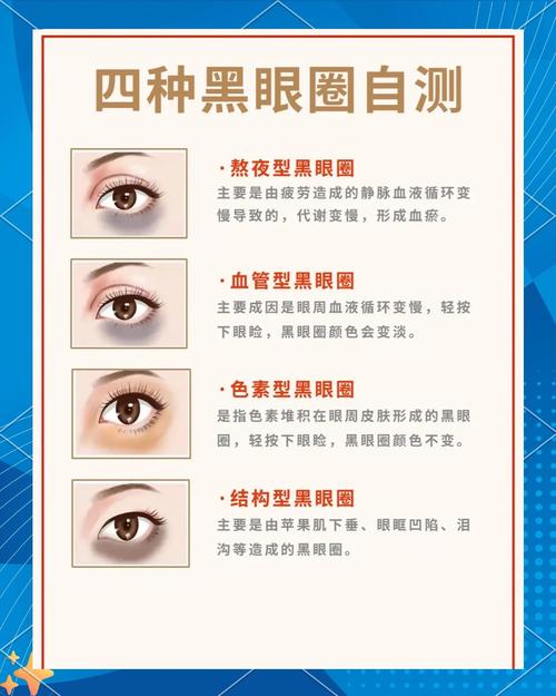 面相圖解：黑眼圈預示著什么