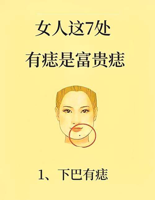 巨富痣和大富痣圖片 顴骨痣一生大富