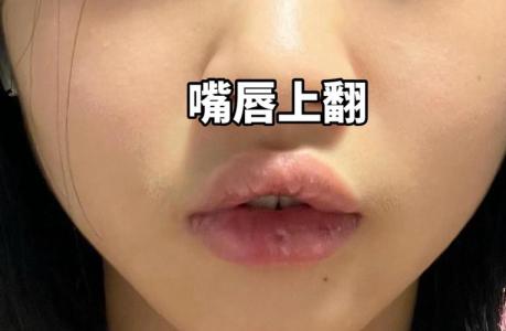 嘴唇翹是好的面相嗎