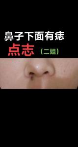 左鼻孔下面有顆痣好不好 積極樂觀