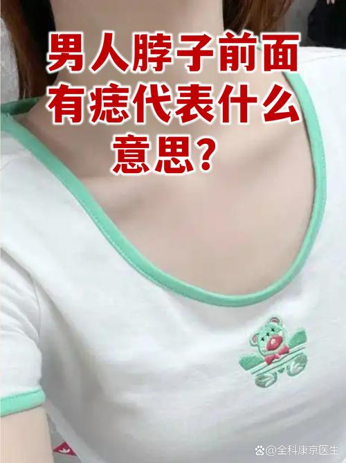 男人脖子前面有痣代表什么 脖子上長紅痣命理解析
